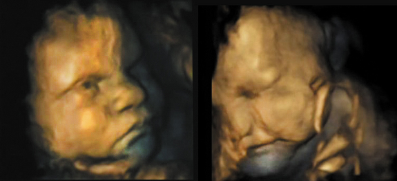 baby-faces womb